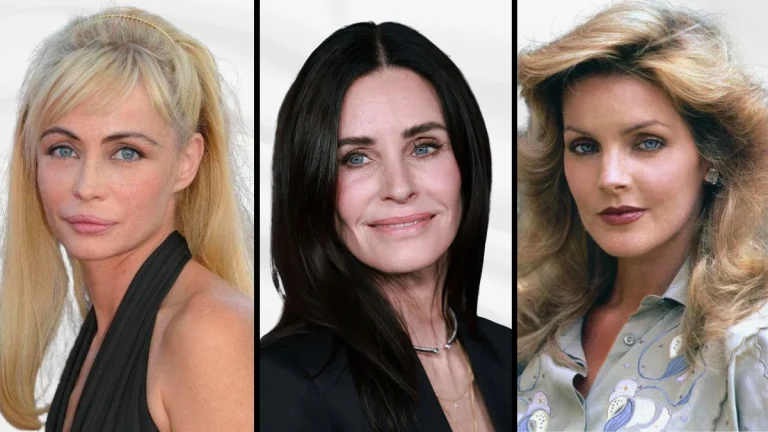 Actresses Who Successfully Covered Up Cosmetic Procedures Gone Wrong