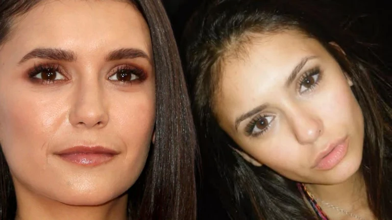 Nina Dobrev Sizzles in Jaw-Dropping Bikini Photo — Fans Can’t Stop Staring
