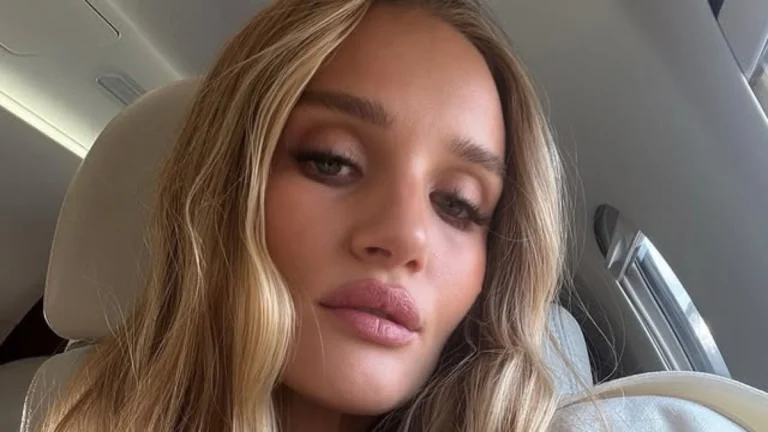 Rosie Huntington-Whiteley’s Puffy Vogue Australia Appearance Triggers Wave of Online Speculation